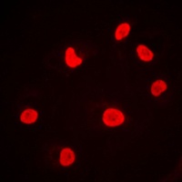 DNA-PKcs Rabbit Polyclonal Antibody