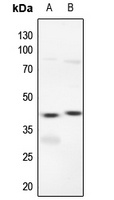 ERK1/2 Rabbit Polyclonal Antibody