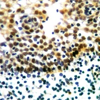ERK1/2 Rabbit Polyclonal Antibody