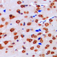 ERK1/2 Rabbit Polyclonal Antibody