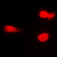 JNK1/2/3 (Phospho-T183) Antibody