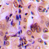 MKK1 (Phospho-T292) Antibody
