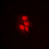 MKK1 (Phospho-T292) Antibody