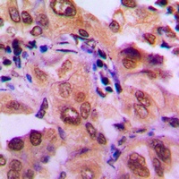 MKK1 Rabbit Polyclonal Antibody