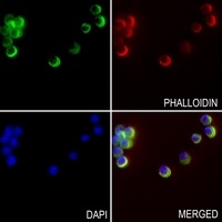 MKK1 Rabbit Polyclonal Antibody