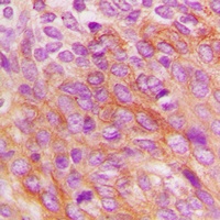 PKR Rabbit Polyclonal Antibody
