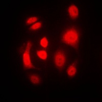 PKR Rabbit Polyclonal Antibody