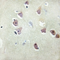 PSMD2 Rabbit Polyclonal Antibody