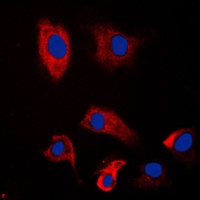 PSMD2 Rabbit Polyclonal Antibody