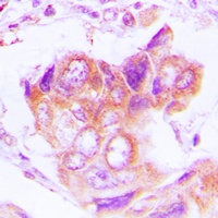 PSMD2 Rabbit Polyclonal Antibody