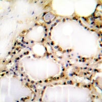 RAD52 (Phospho-Y104) Antibody