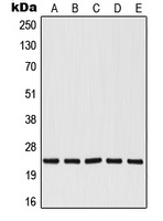 RALB Rabbit Polyclonal Antibody