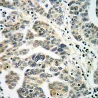 RALB Rabbit Polyclonal Antibody