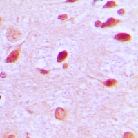RAP1GAP Rabbit Polyclonal Antibody