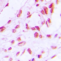 RB1 (Phospho-S780) Antibody