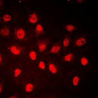 RB1 (Phospho-S780) Antibody