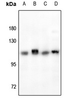 RB1 Rabbit Polyclonal Antibody