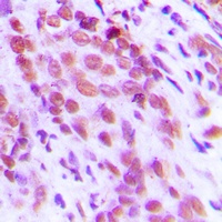 NF-kappaB p65 (Phospho-S276) Antibody
