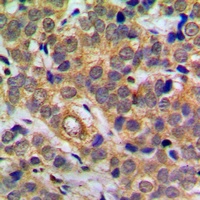NF-kappaB p65 (Phospho-S311) Antibody