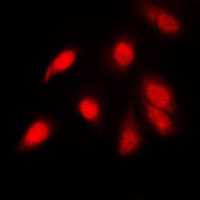 NF-kappaB p65 (Phospho-S311) Antibody