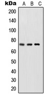 NF-kappaB p65 (Phospho-S468) Antibody