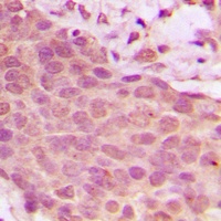 NF-kappaB p65 (Phospho-S536) Antibody