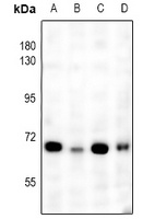 NF-kappaB p65 Rabbit Polyclonal Antibody