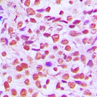 NF-kappaB p65 Rabbit Polyclonal Antibody