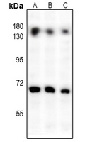 NF-kappaB p65 Rabbit Polyclonal Antibody