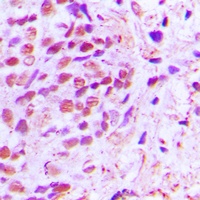 NF-kappaB p65 Rabbit Polyclonal Antibody