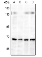 NF-kappaB p65 Rabbit Polyclonal Antibody