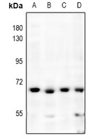 NF-kappaB p65 Rabbit Polyclonal Antibody