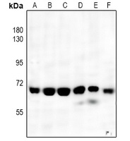 NF-kappaB p65 Rabbit Polyclonal Antibody