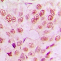 NF-kappaB p65 Rabbit Polyclonal Antibody