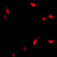 NF-kappaB p65 Rabbit Polyclonal Antibody