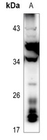 RNASE3 Rabbit Polyclonal Antibody