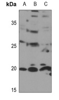 RPL11 Antibody