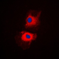 RPL27A Rabbit Polyclonal Antibody