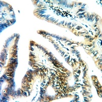RPS4X Rabbit Polyclonal Antibody