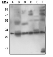 RPS4Y1 Rabbit Polyclonal Antibody