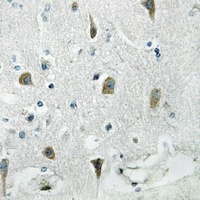 RPS4Y1 Rabbit Polyclonal Antibody