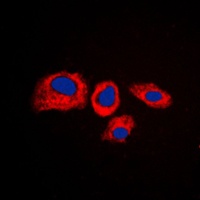 RPS4Y1 Rabbit Polyclonal Antibody