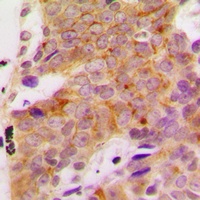 S6K1 (Phospho-S418) Antibody