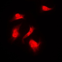 S6K1 (Phospho-S418) Antibody