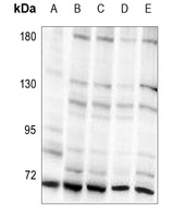 S6K1 (Phospho-T421) Rabbit Polyclonal Antibody