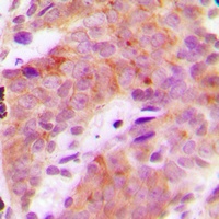 S6K1 (Phospho-T421) Rabbit Polyclonal Antibody