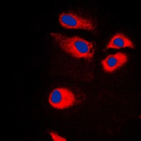 RPS9 Rabbit Polyclonal Antibody