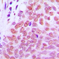 RXR gamma Rabbit Polyclonal Antibody