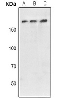 Ataxin 2 Rabbit Polyclonal Antibody