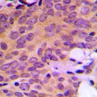 Ataxin 2 Rabbit Polyclonal Antibody